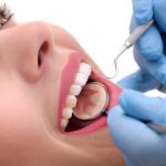 Profilaxie si estetica dentara Pitesti